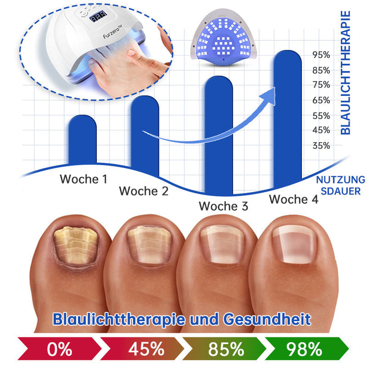 BowLift | PureNail™ | Nail Fungus Laser Therapy Device - Your Secret Weapon Against Nail Fungus