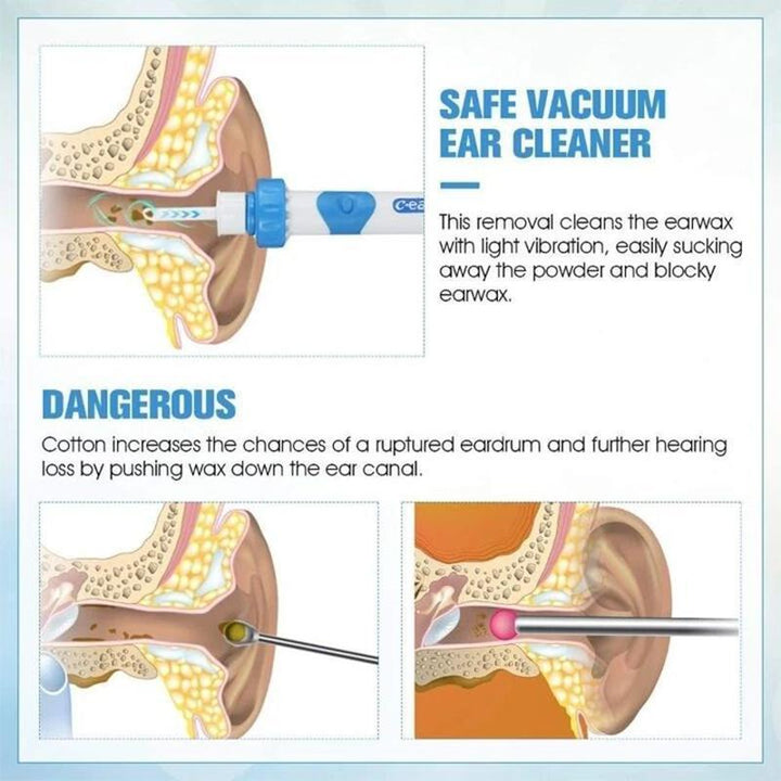 BowLift | Ear Wax Remover Vacuum Cleaner