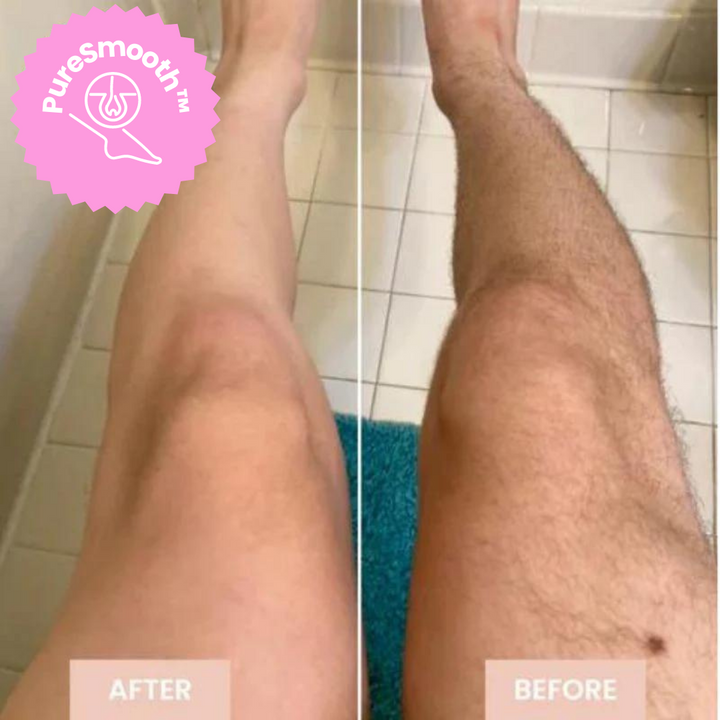 BowLift | LuxeLaser Flawless Hair Removal in 60 Seconds