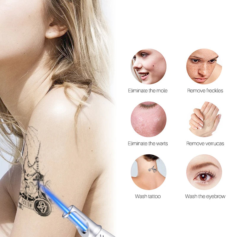 BowLift | Smart Tattoo Removal Laser Pen - Remove moles, freckles, acne, tattoos