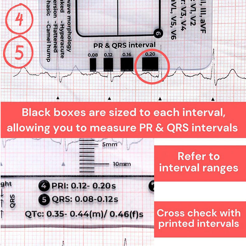 BowLift | ECG 7 Step Ruler
