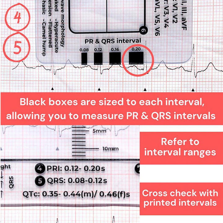 BowLift | ECG 7 Step Ruler