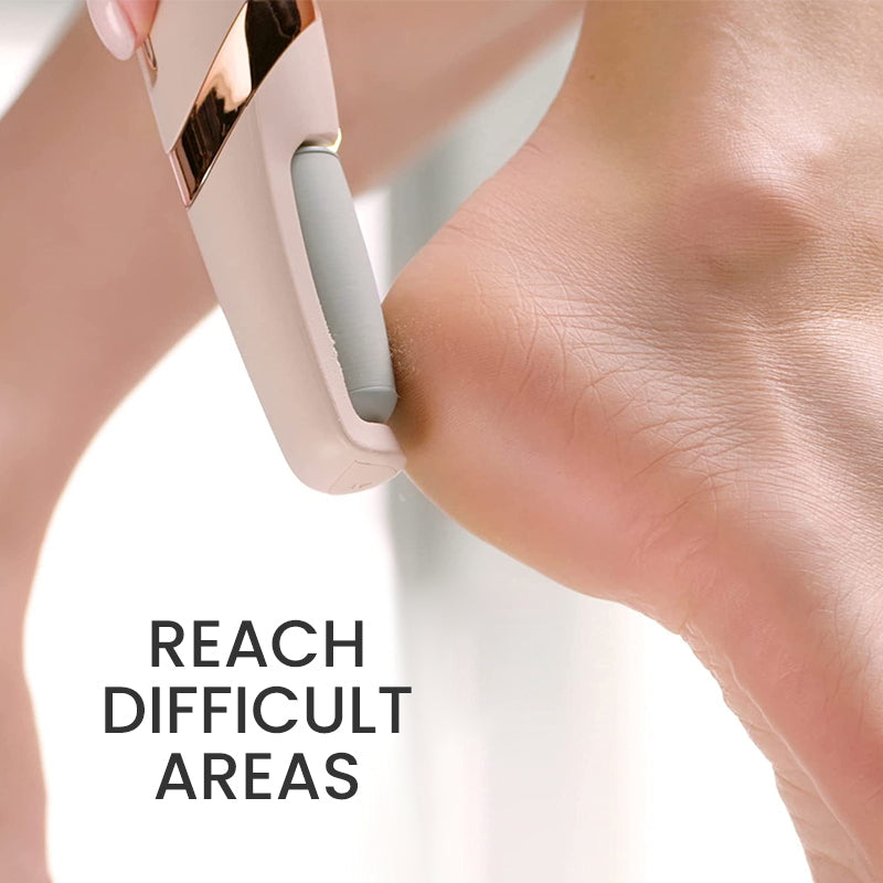 BowLift | Rechargeable Pedicure Tool USB Cordless Electric Foot File