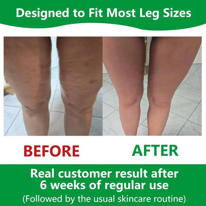 BowLift | Sakerplus Cellulite Massage Roller