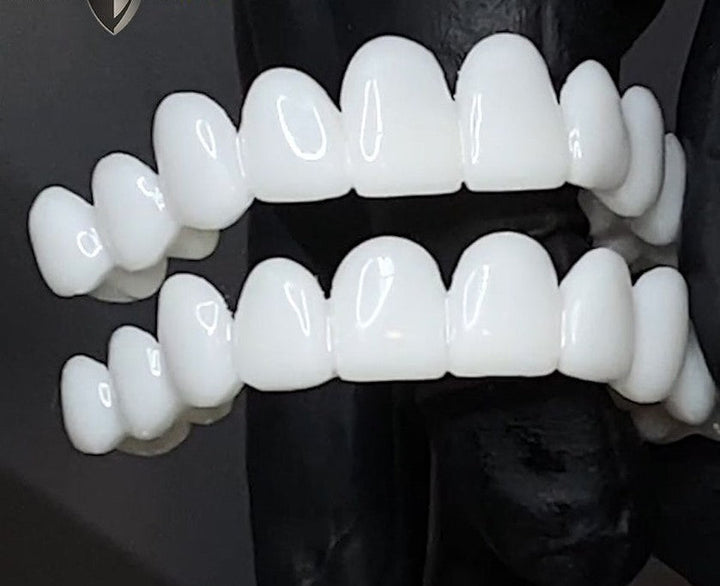 dental prosthesis