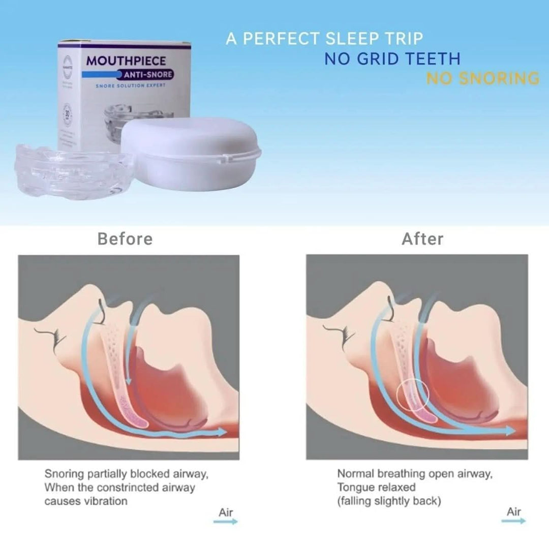 BowLift | Anti-snoring mouthpiece against sleep apnoea & snoring