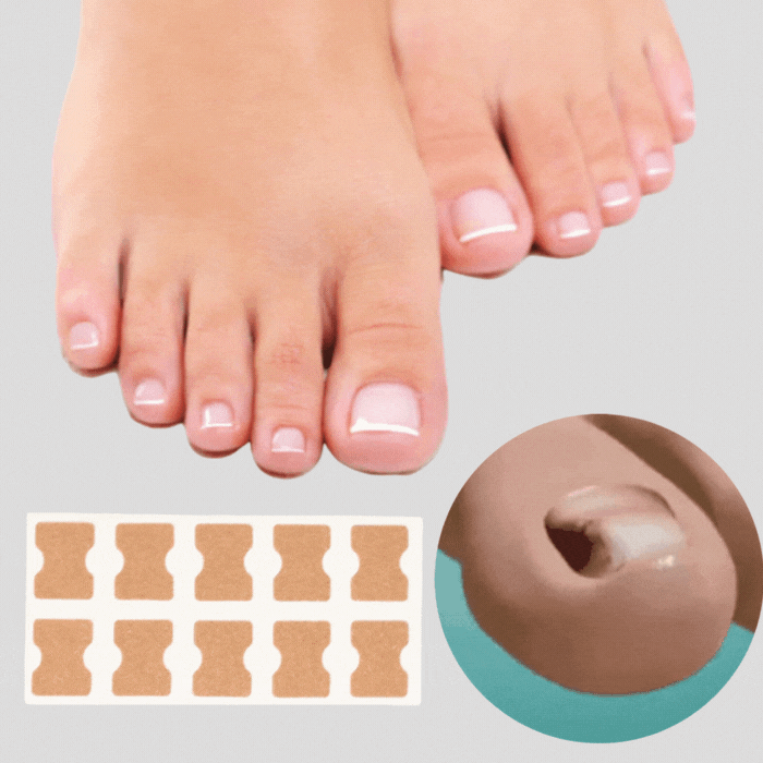 BowLift | ProFlexiPatches — Pain-free natural nails that you show off again with pride