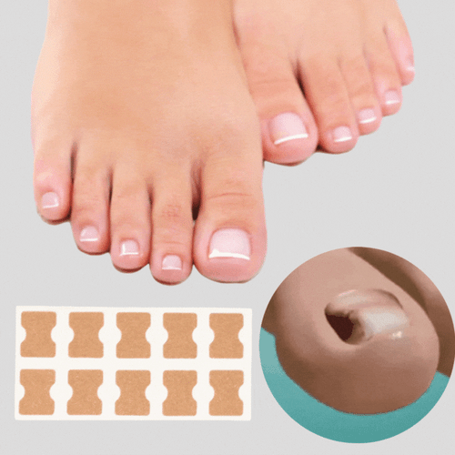 BowLift | ProFlexiPatches — Pain-free natural nails that you show off again with pride