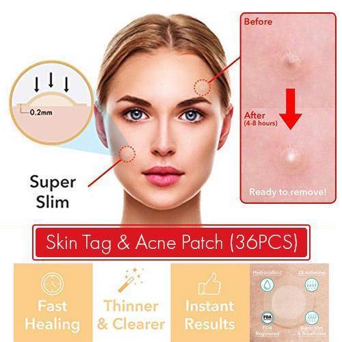BowLift | Skin Tag and Acne Patch