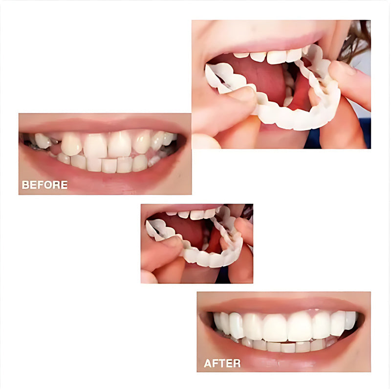 BowLift | Simulation whitening dentures