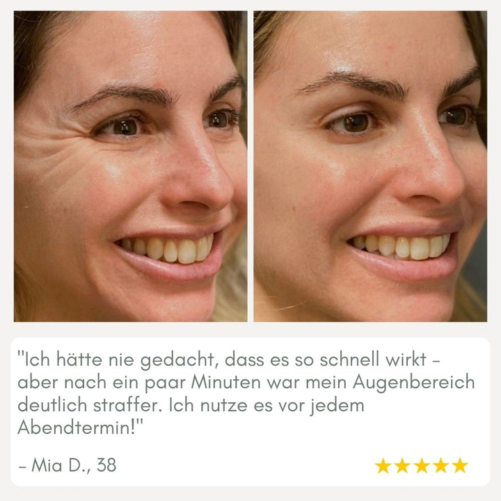BowLift | YouthMorph — Tight skin in minutes for your youthful WOW moment