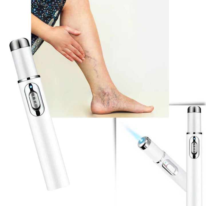 ClearGlow Blue Light Skin Therapy Pen | Acne Treatment - Anti-inflammatory - Non-invasive Solution - Clearer Skin - Blemish Reduction Bowlift