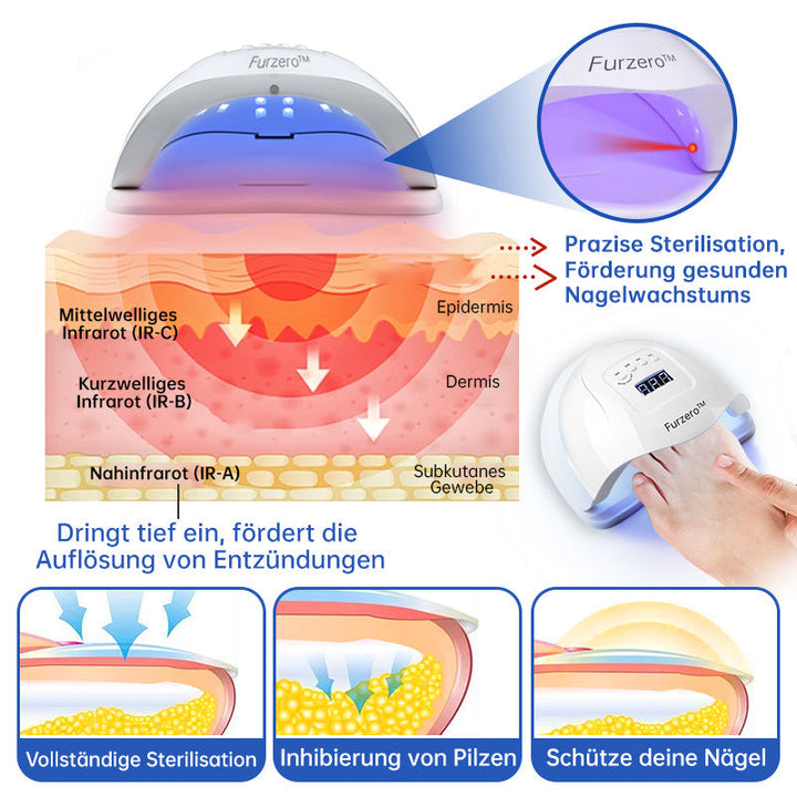 BowLift | PureNail™ | Nail Fungus Laser Therapy Device - Your Secret Weapon Against Nail Fungus