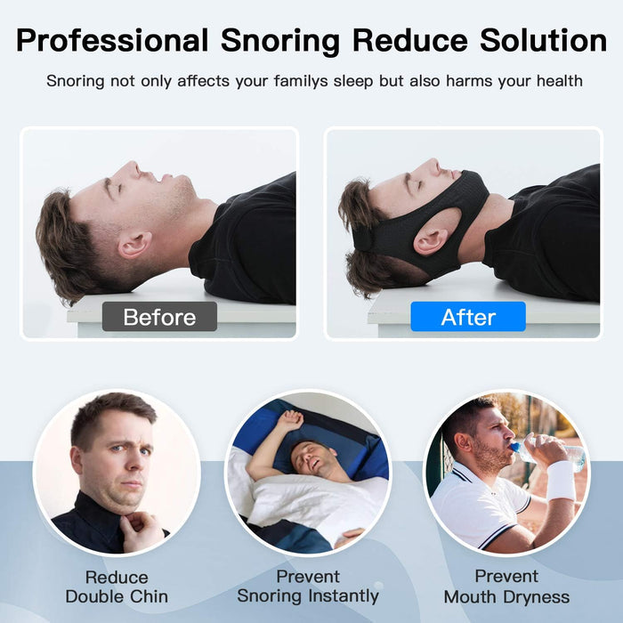 BowLift | SnoreGuard - Comfortable Chin Strap for a Silent and Peaceful Sleep