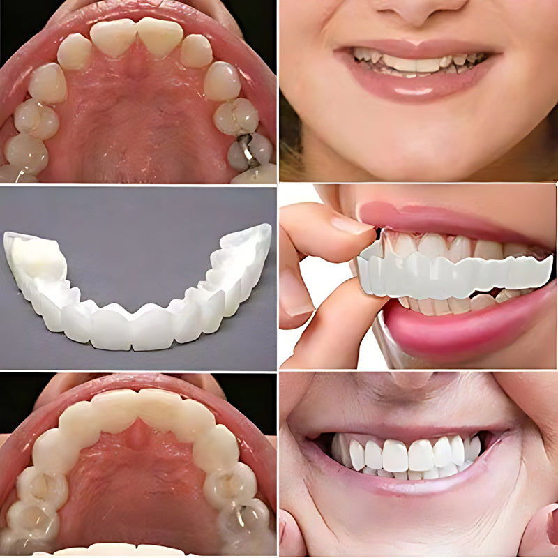 BowLift | Simulation whitening dentures