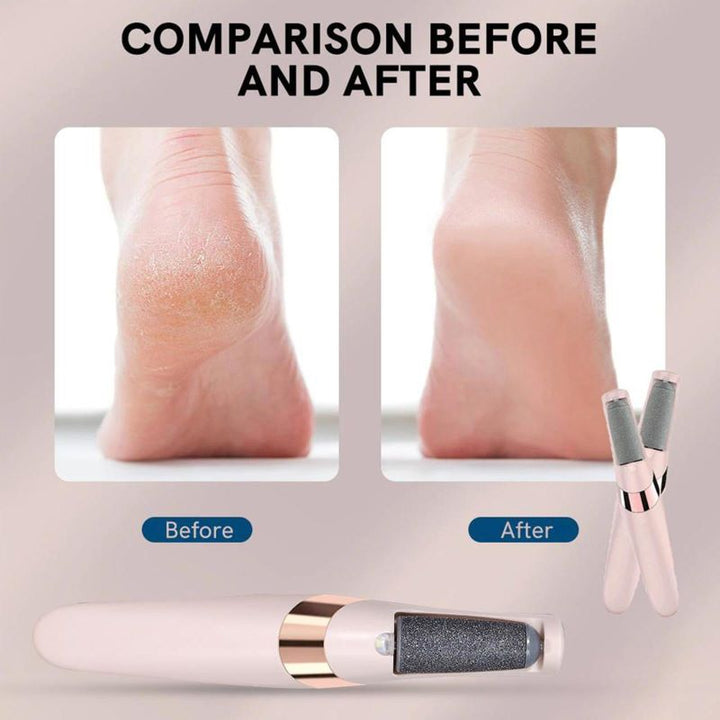 Electric Foot File Hard Skin Remover Bowlift