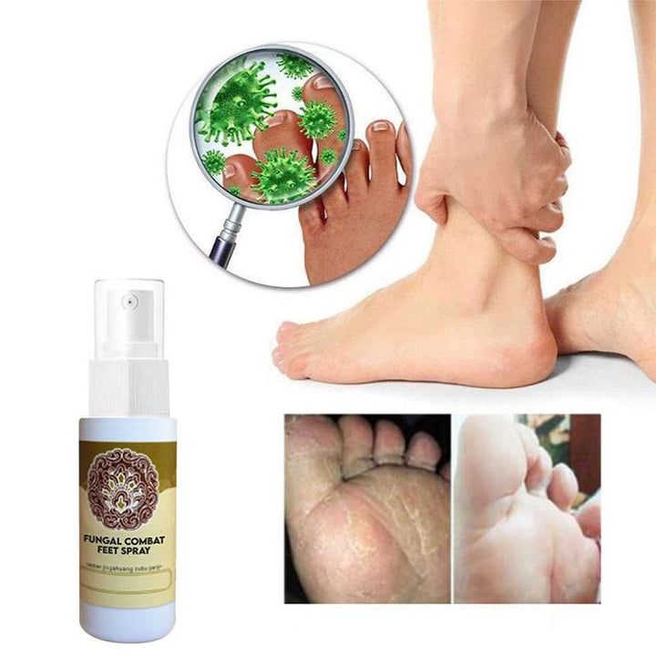 BowLift | Foot deodorant and moisture absorber spray