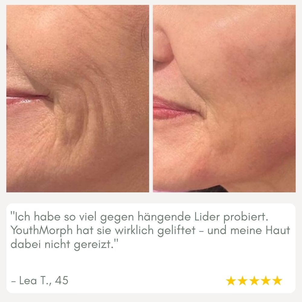 BowLift | YouthMorph — Tight skin in minutes for your youthful WOW moment