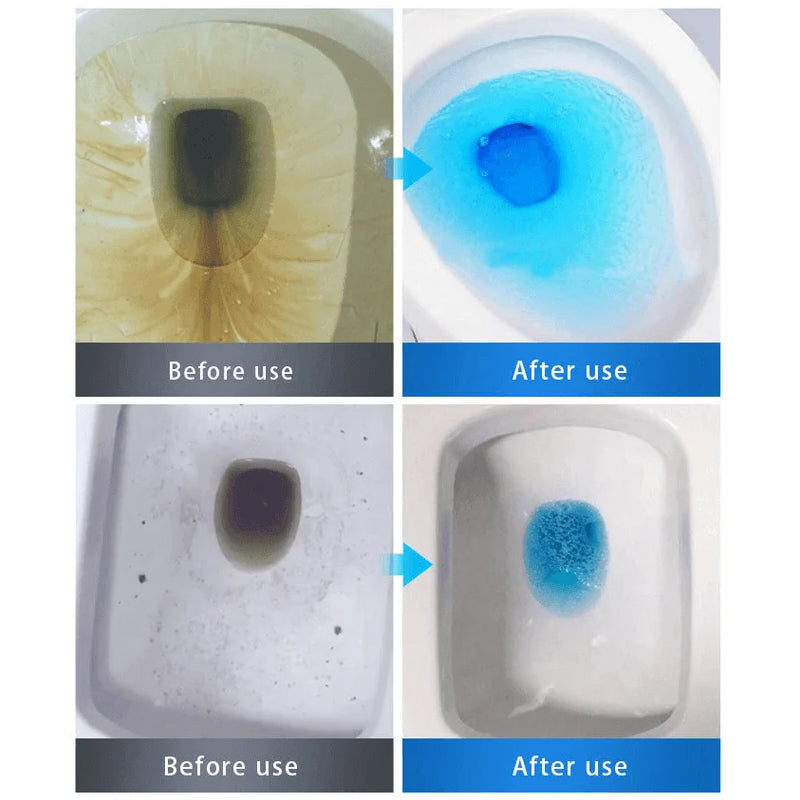 Powerful Sink & Drain Cleaner | Bowlift