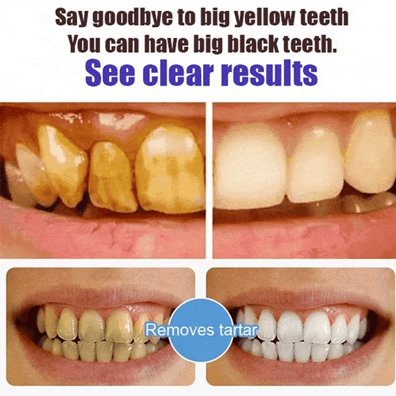 BowLift | Super Probiotic-6 Toothpaste