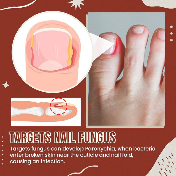 BowLift | Nail Anti-Fungus Socks