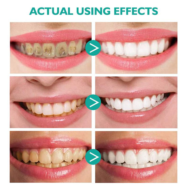 BowLift | Whitening Foam Toothpaste
