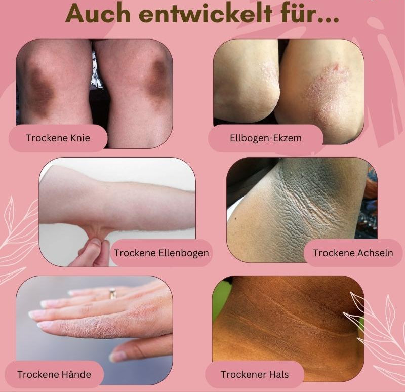 BowLift | Dermashield — Quick relief for cracked, itchy feet that want to breathe freely