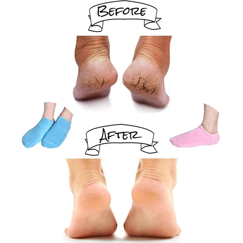 BowLift | Moisturizing socks with gel lining