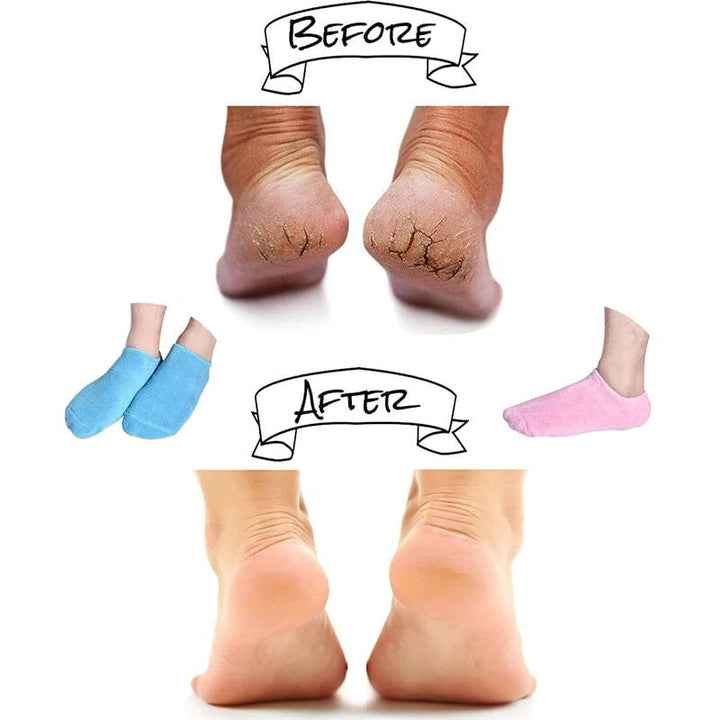 BowLift | Moisturizing socks with gel lining