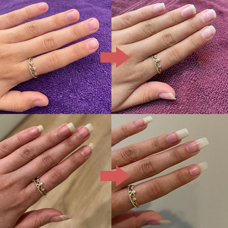 BowLift | Nails Nutrient-Rich Growth Oil
