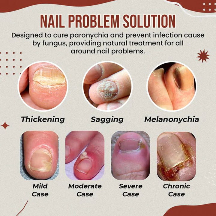 BowLift | Nail Anti-Fungus Socks