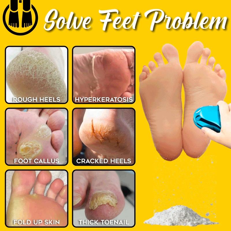 BowLift | Mini Pedicure Tool
