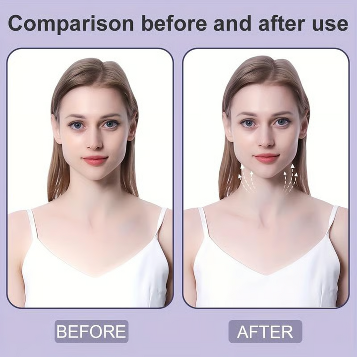 BowLift | VelvetLift — Shine instantly youthful and confident with invisible power lift