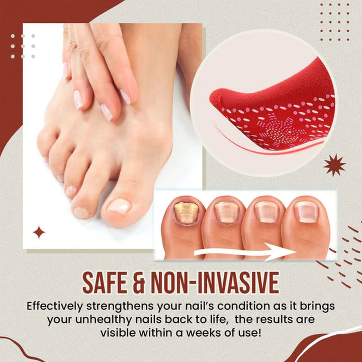 BowLift | Nail Anti-Fungus Socks