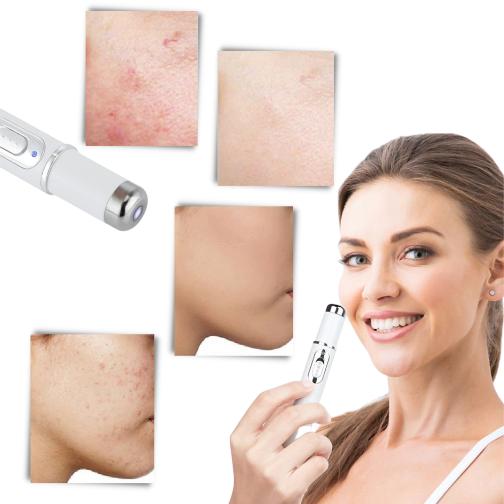 BowLift | Blue light skin therapy pen