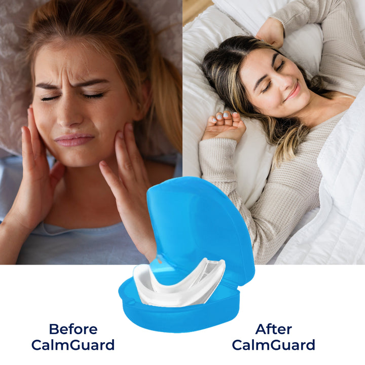 CalmGuard | Night Mouth Guard – Bruxism Relief – Custom-Fit – For Teeth Grinding & Jaw Clenching Bowlift