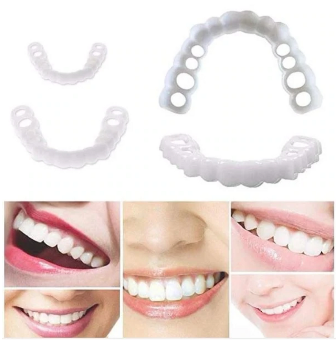 BowLift | HappySmile Facet set | Reusable upper and lower facets for a radiant smile