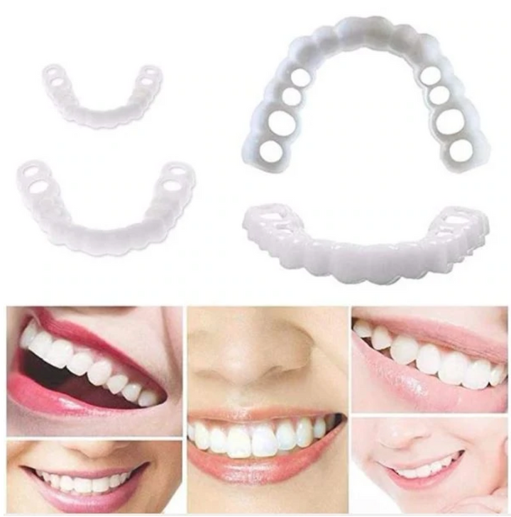 BowLift | HappySmile Facet set | Reusable upper and lower facets for a radiant smile