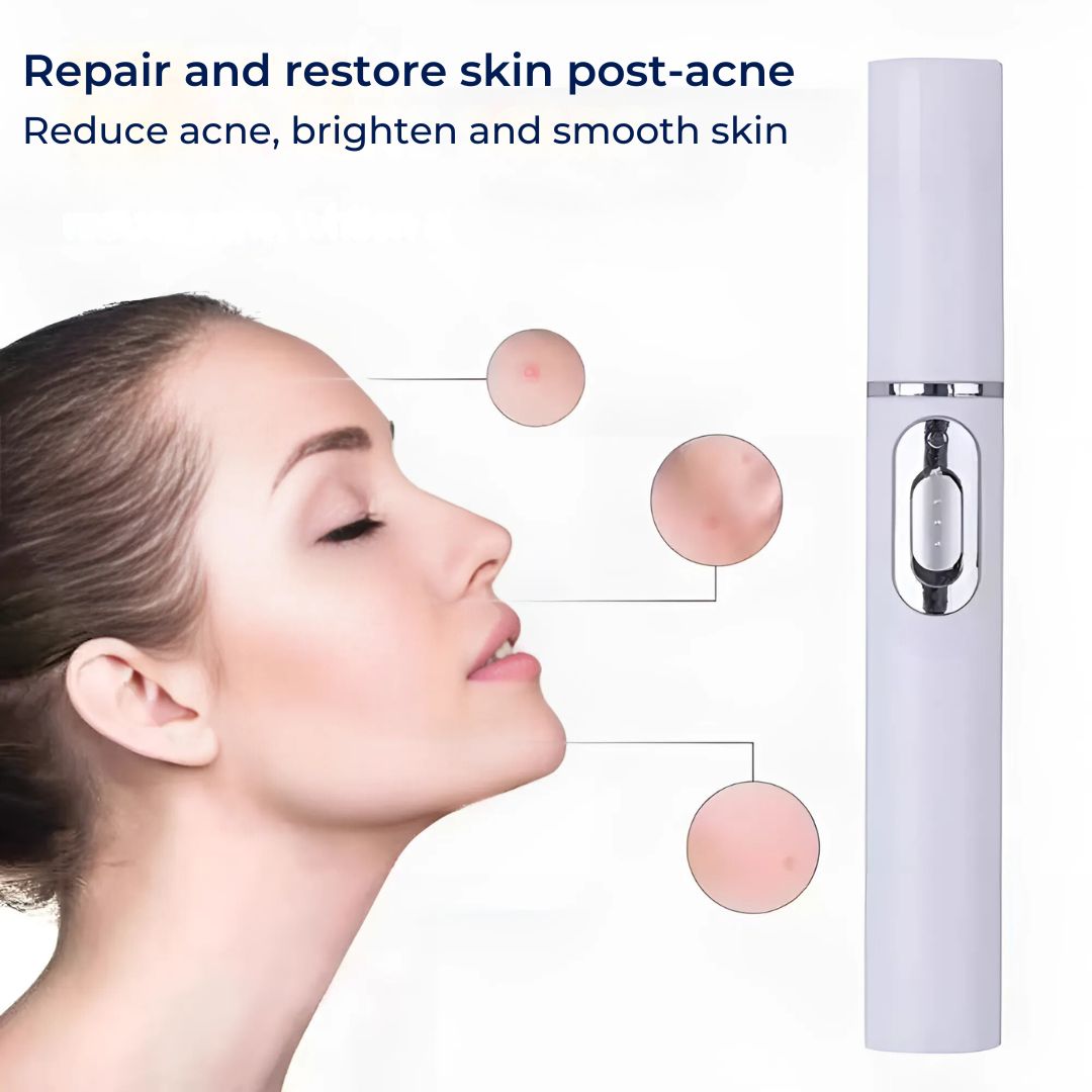 ClearGlow Blue Light Skin Therapy Pen | Acne Treatment - Anti-inflammatory - Non-invasive Solution - Clearer Skin - Blemish Reduction Bowlift