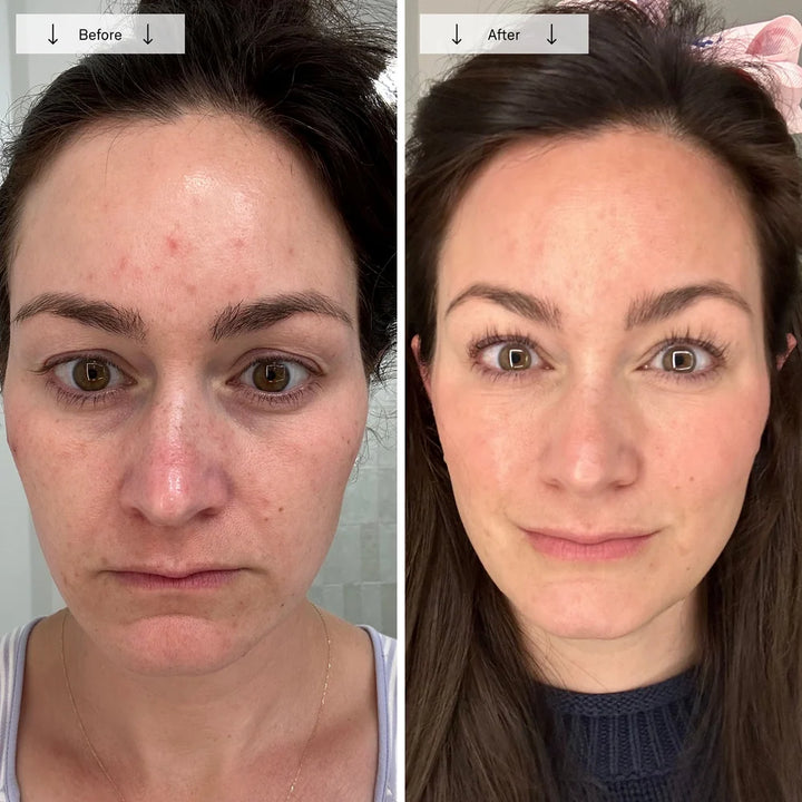 Red Light Therapy Face Mask for Wrinkles & Skin Rejuvenation