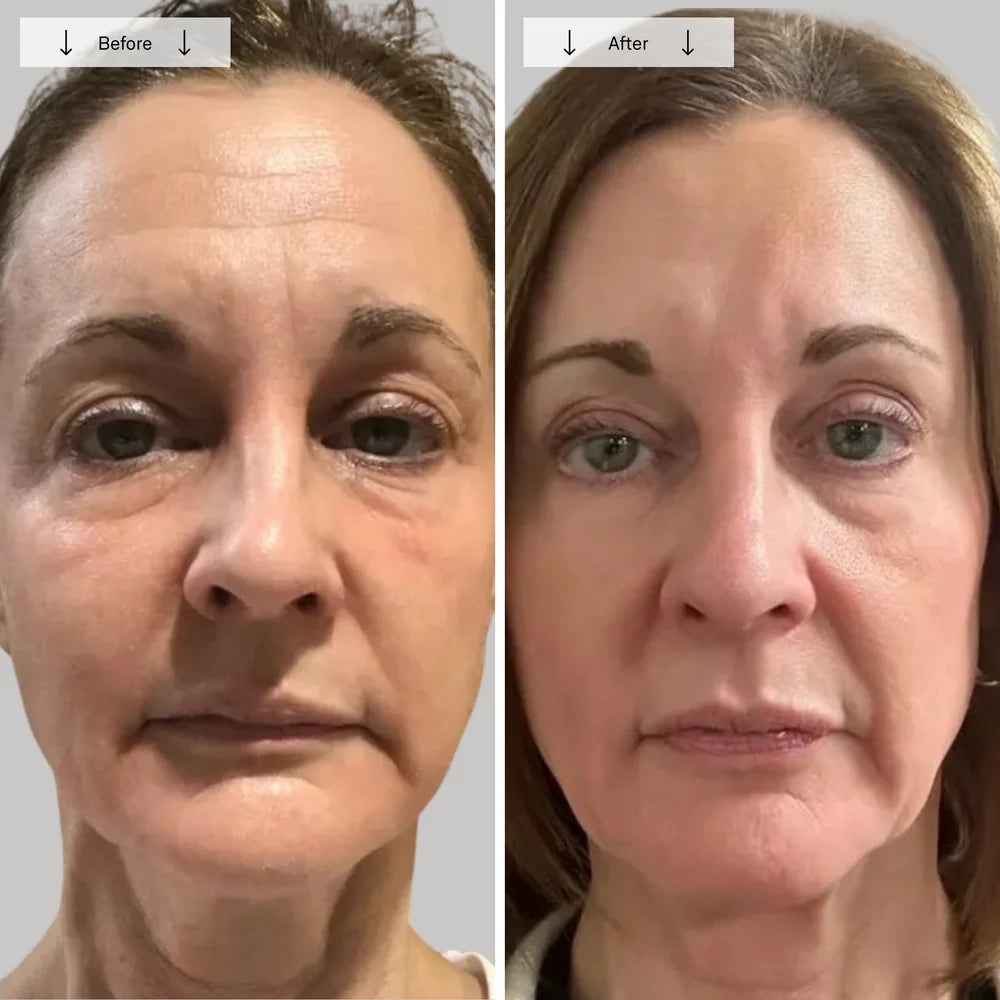 Red Light Therapy Face Mask for Wrinkles & Skin Rejuvenation
