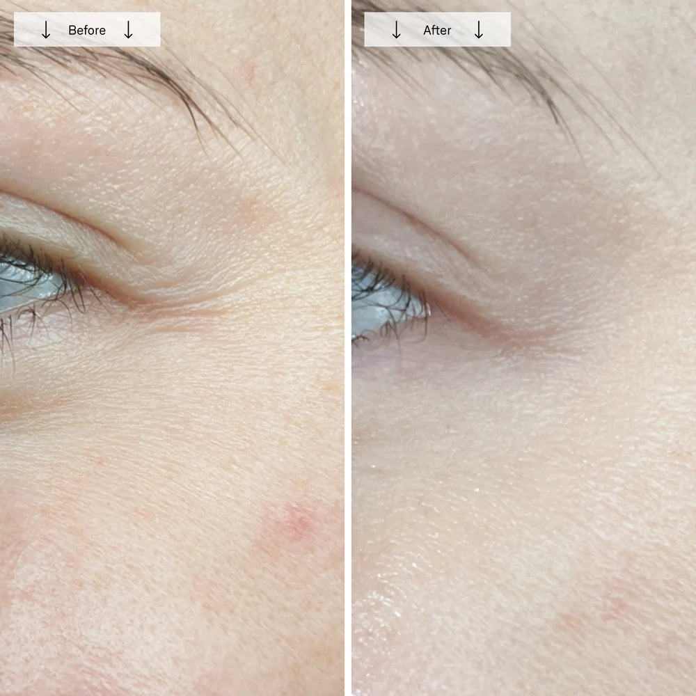 Red Light Therapy Face Mask for Wrinkles & Skin Rejuvenation