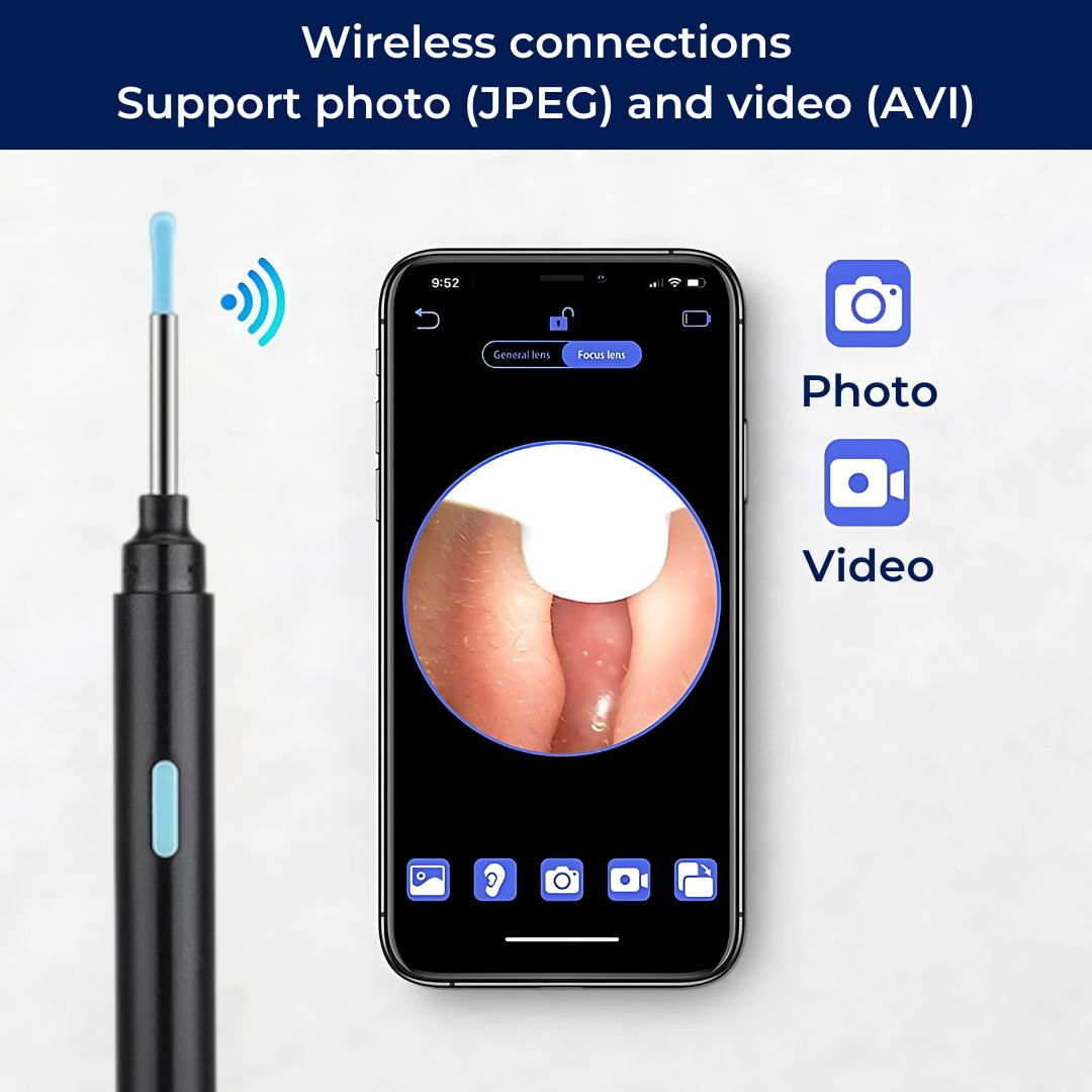 EarScope Pro - Smart Visual Earwax Removal Tool | LED Camera and Soft Tips - Safe and Precise Ear Cleaning Bowlift