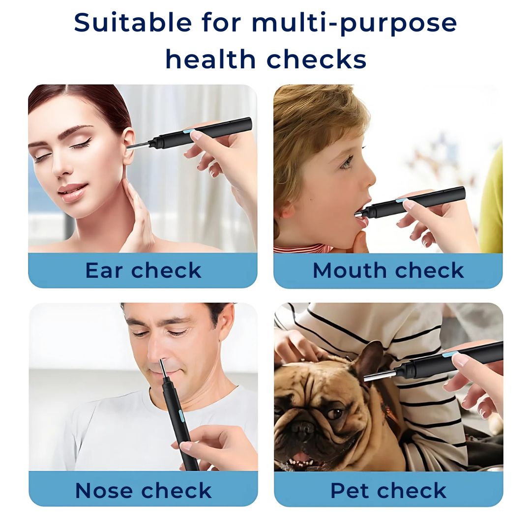 EarScope Pro - Smart Visual Earwax Removal Tool | LED Camera and Soft Tips - Safe and Precise Ear Cleaning Bowlift