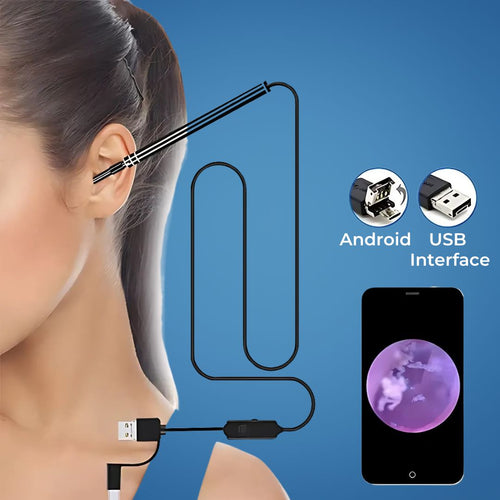 EarVision Professional Ear Endoscope – HD Inspection – Live Monitoring – Capture Images & Video – Removes Wax & Foreign Objects Bowlift