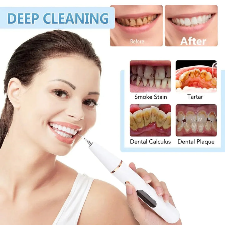 BowLift | Ultrasonic Teeth Cleaning Device | 38 kHz Ultrasound, LED Light & USB Fast Charging for Home Dental Care