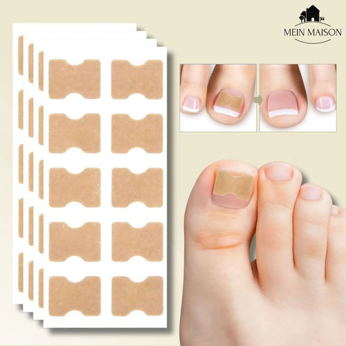 BowLift | FixaNail – Painless nail correction for ingrown & deformed nails