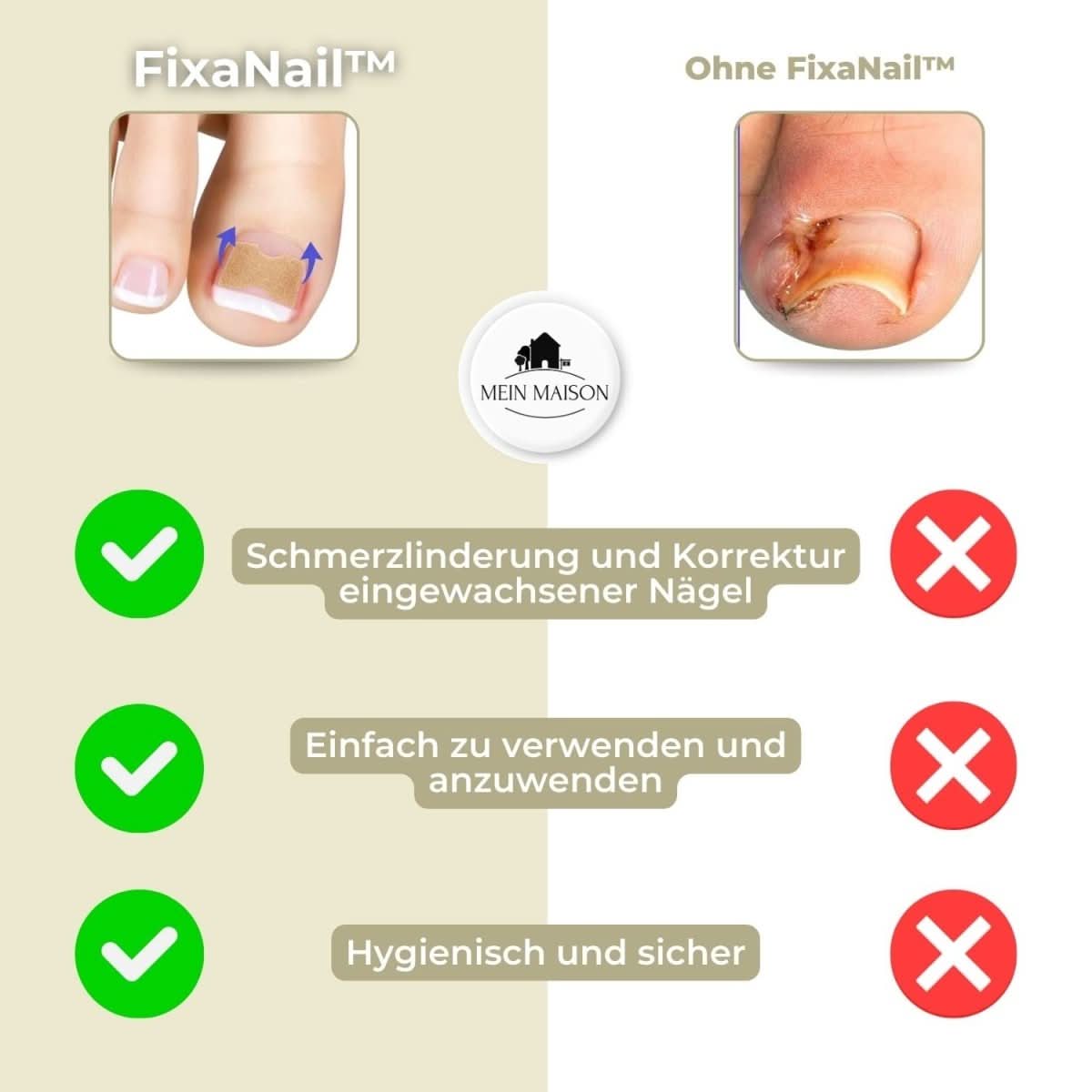 BowLift | FixaNail – Painless nail correction for ingrown & deformed nails