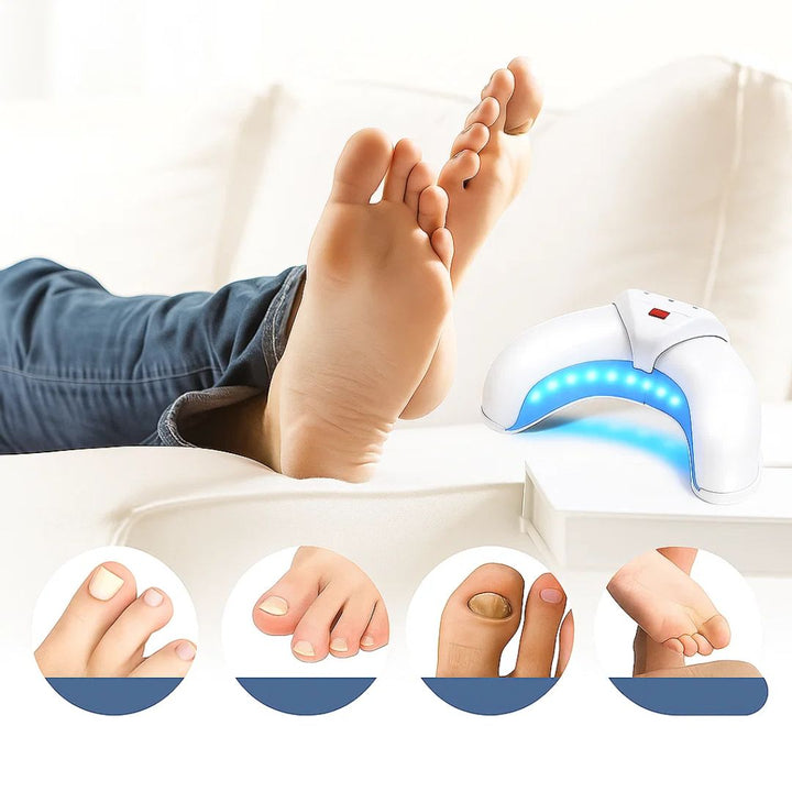 FungiFree | Laser Nail Fungus Device – Dual‑Wavelength Penetration – Compact Home Use – Fungal Nail Restoration Bowlift