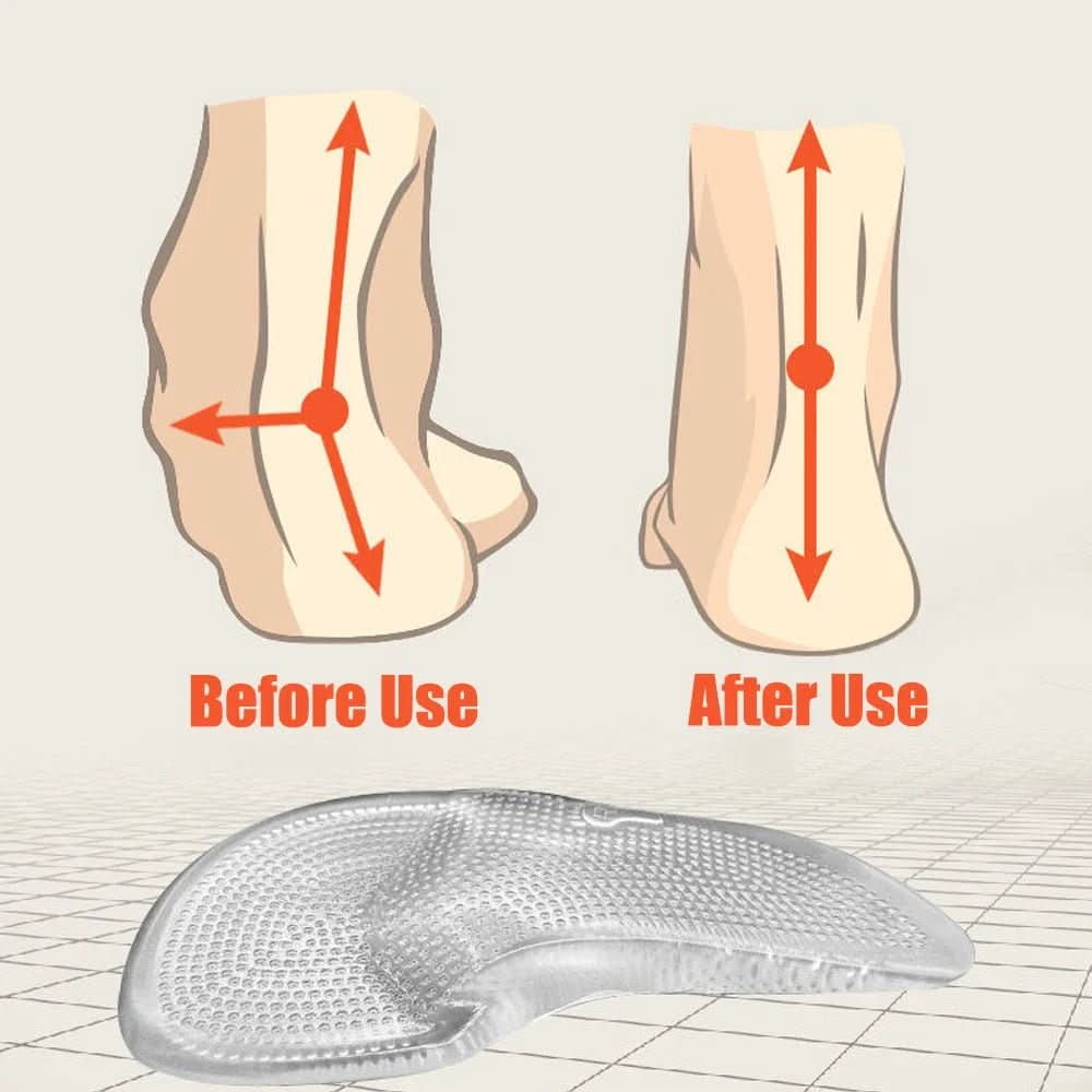 BowLift | Orthopedic Gel Insoles for supportive arch support